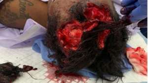 tamika bates scalp