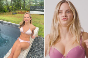 Victoria's Secret Has Finally Introduced Its First Model With Down Syndrome