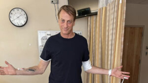 Tony Hawk Broke His Leg and Says He May Not Make a Full Recovery