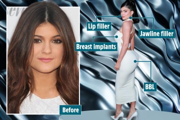 I’m a plastic surgeon, signs Kylie Jenner may have spent at least $48k on work