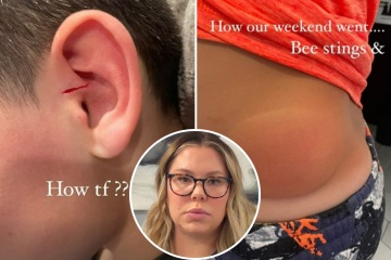 Teen Mom Kailyn Lowry sparks concern with shocking photos of sons' injuries