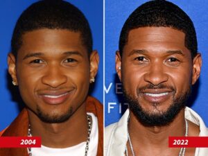 Usher -- Good Genes Or Good Docs?!