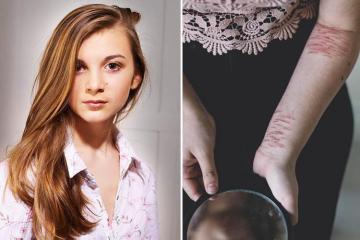 Inside the sinister self-harm blogs and hashtags driving teens to cut themselves