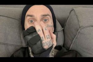 Blink-182's Travis Barker having surgery on ring finger ahead of world tour