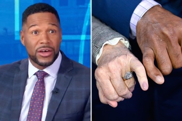 GMA's Michael Strahan sparks concern as he shows off his crooked body part