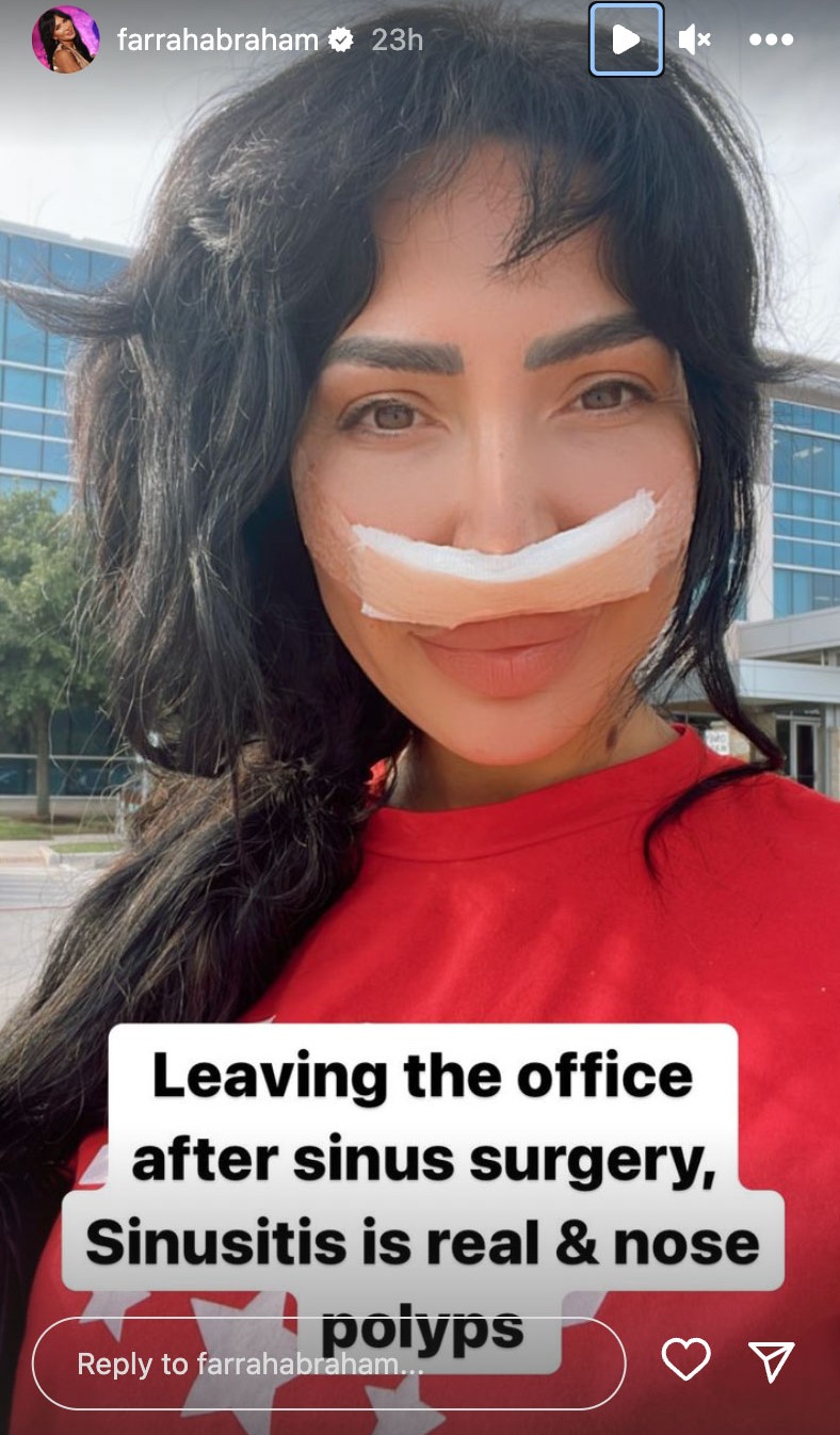 The star had previously showed off her bandaged face and revealed she had nasal surgery