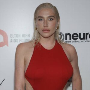 Kesha ‘almost died’ after egg freezing procedure - Music News