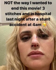 Rebel Wilson Suffered A Stunt Mishap That Left Her Bloodied: 'Three Stitches And In Hospital'