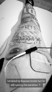 Travis Barker showed off his leg injury in a new photo
