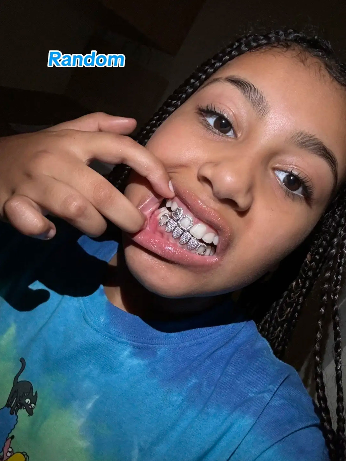 The pre-teen had eight of her front teeth encrusted in tiny diamonds