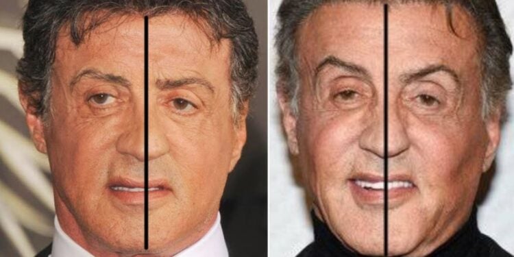 Sylvester Stallone asymmetrical face
