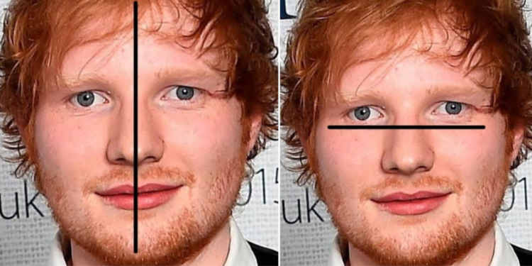 Ed Sheeran asymmetrical face