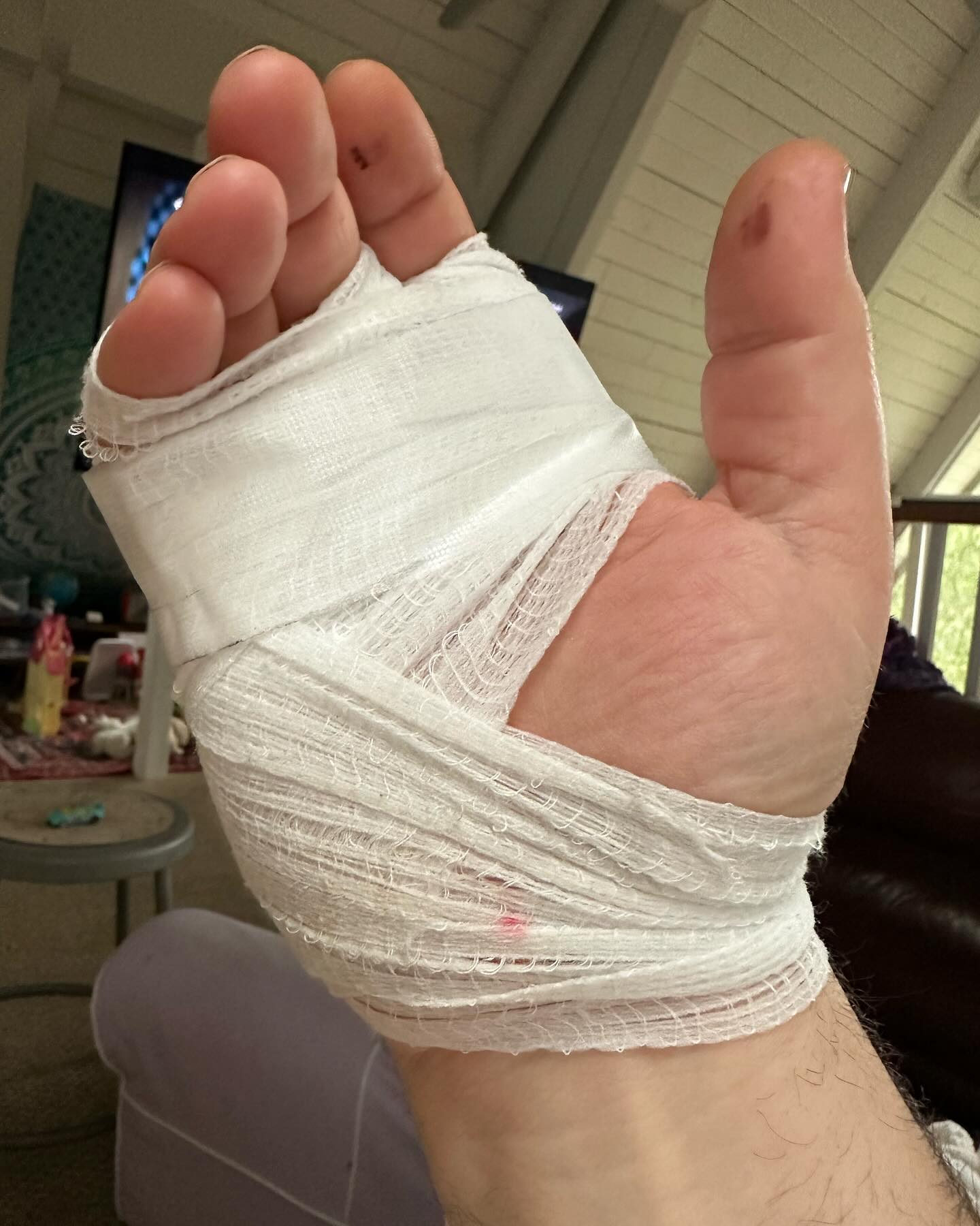 The TV personality and pastry chef revealed he injured his hand in the crash