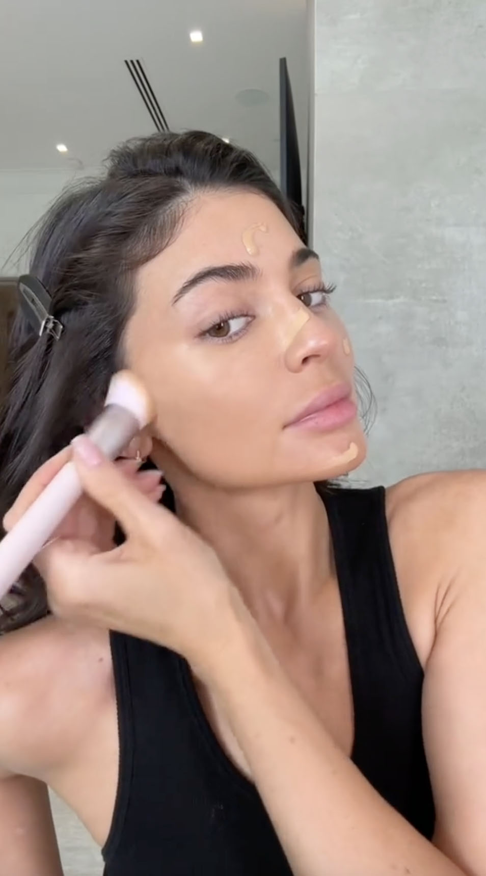 Kylie dissolved her lip filler for a more natural look