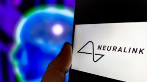 Elon Musk announced that Neuralink has completed the first human brain implant