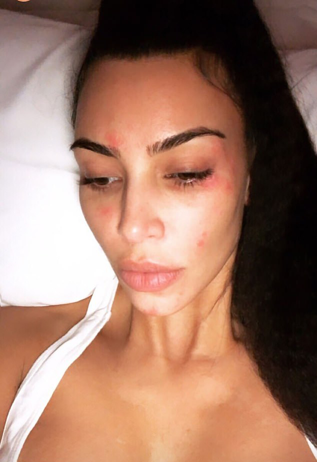 She has shared videos and photos of her breakouts online