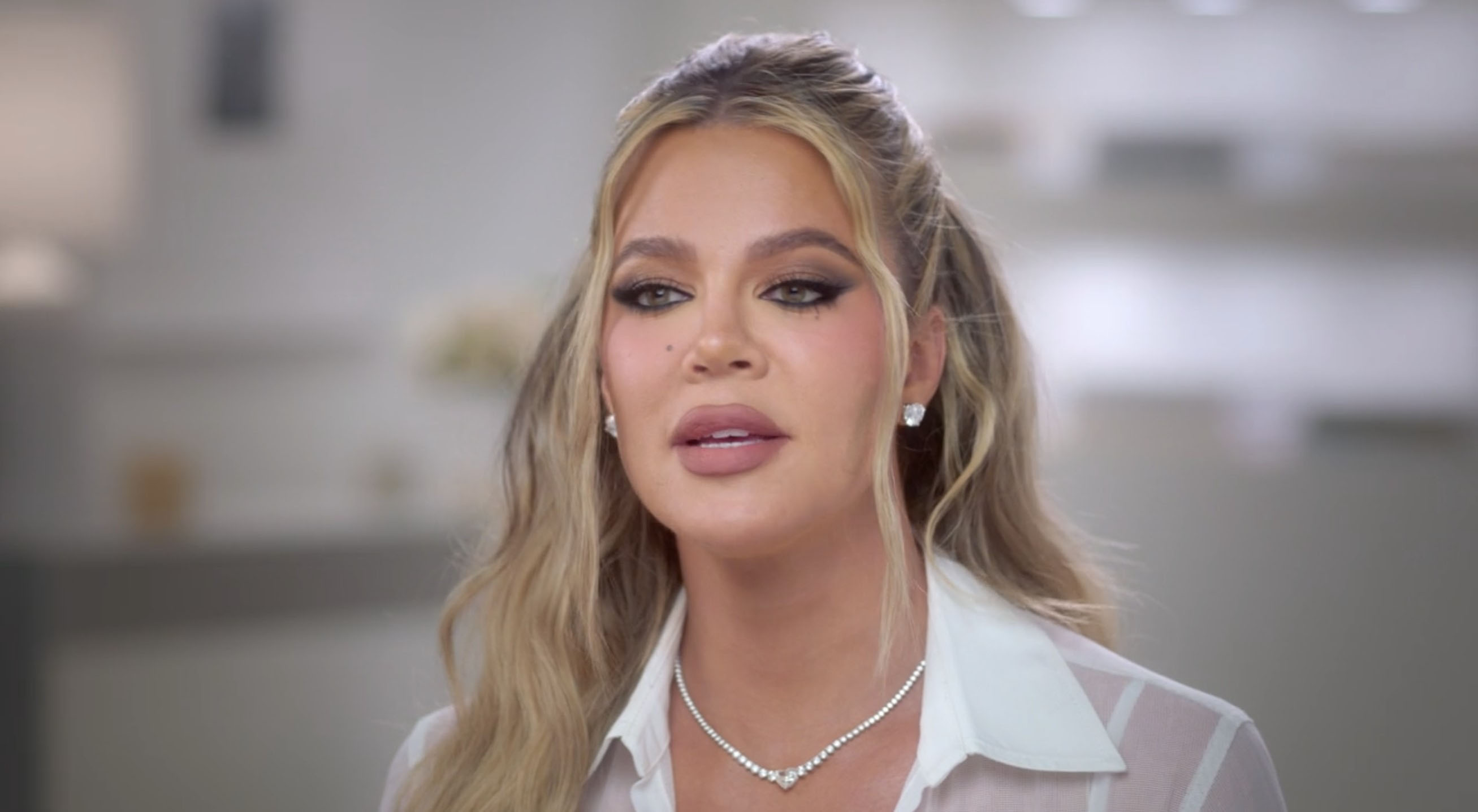 Khloe admitted in January 2021 to getting a nose job and Botox