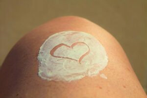 This Is the Worst Place on Your Body You Can Get a Sunburn