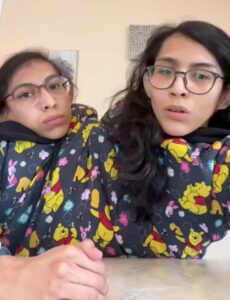 Carmen and Lupita Andrade slammed a TikTok creator for creating 'exploitative' videos on conjoined twins