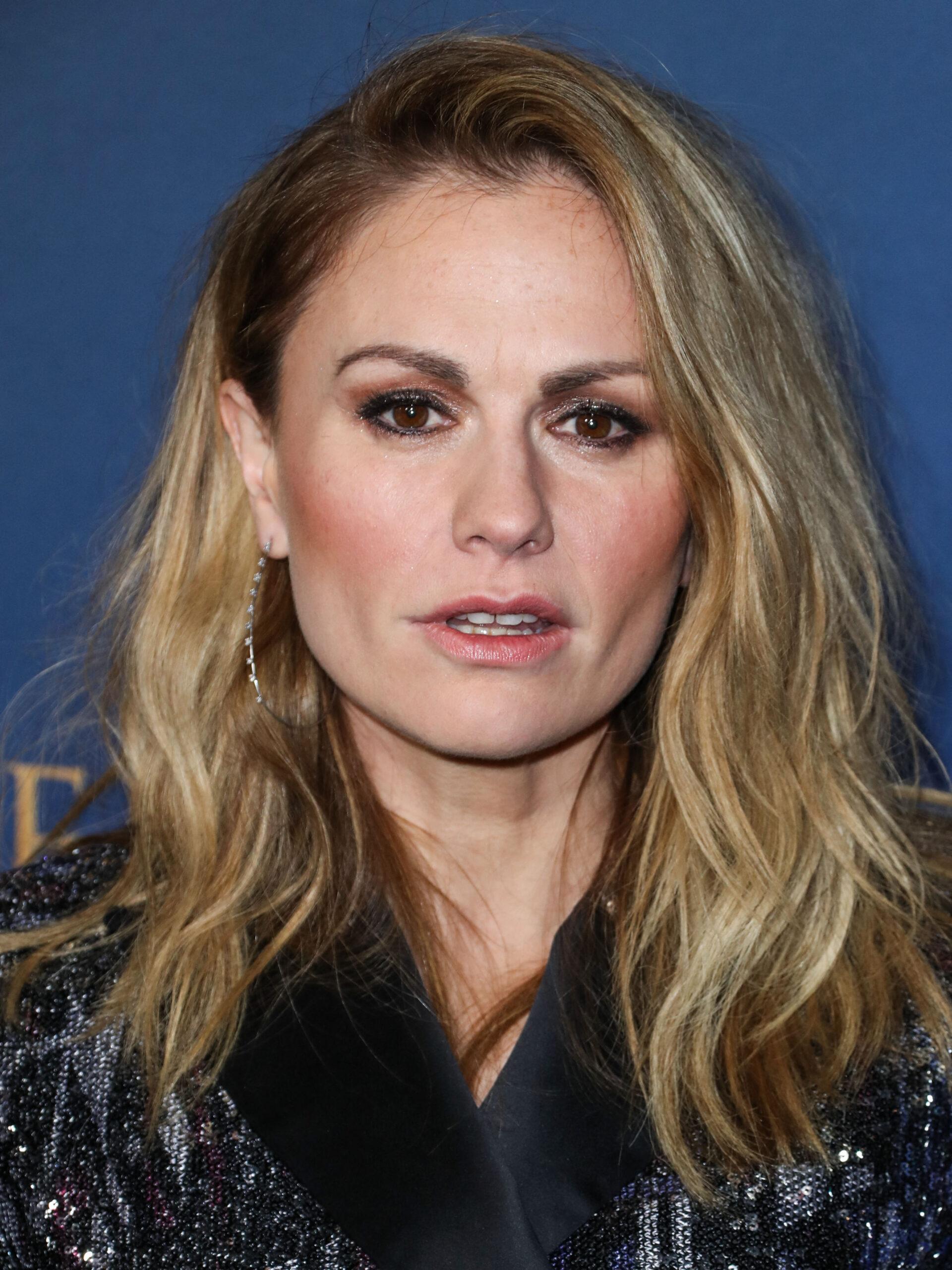 Anna Paquin Admits It ‘Hasn’t Been Easy’ As She Relies On A Cane Amid Mysterious Health Issues