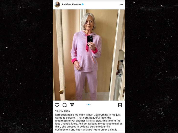 Kate Beckinsale Sparks Concern After Posting Photo of Mom with Bruised ...