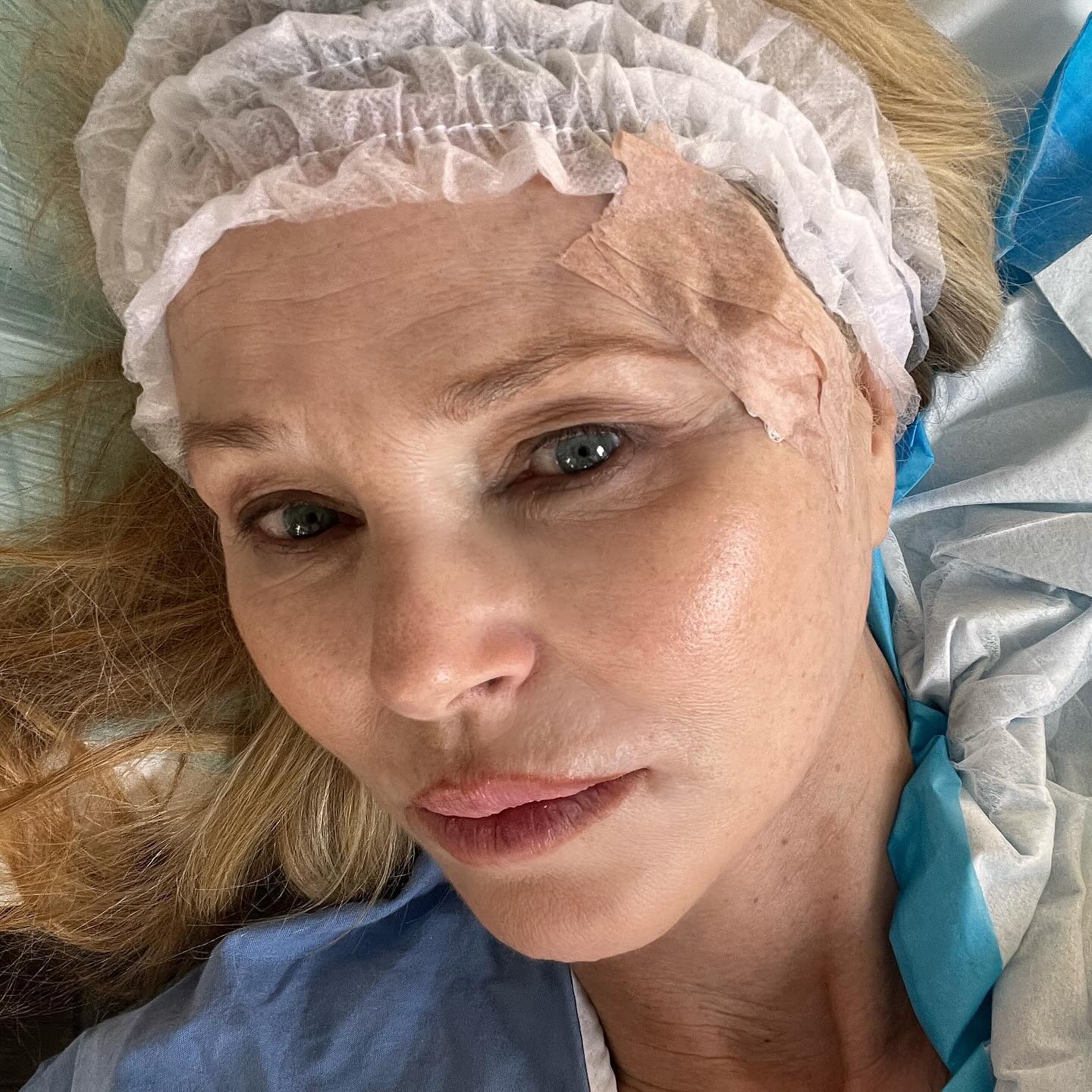 The model underwent surgery to remove the cancer in March, leaving scars on her face