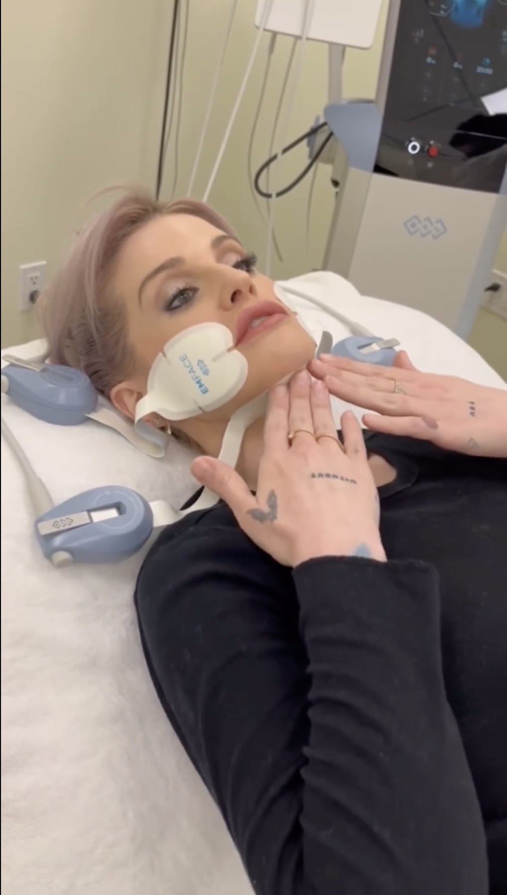 The reality star had a face and body sculpting treatment earlier this week
