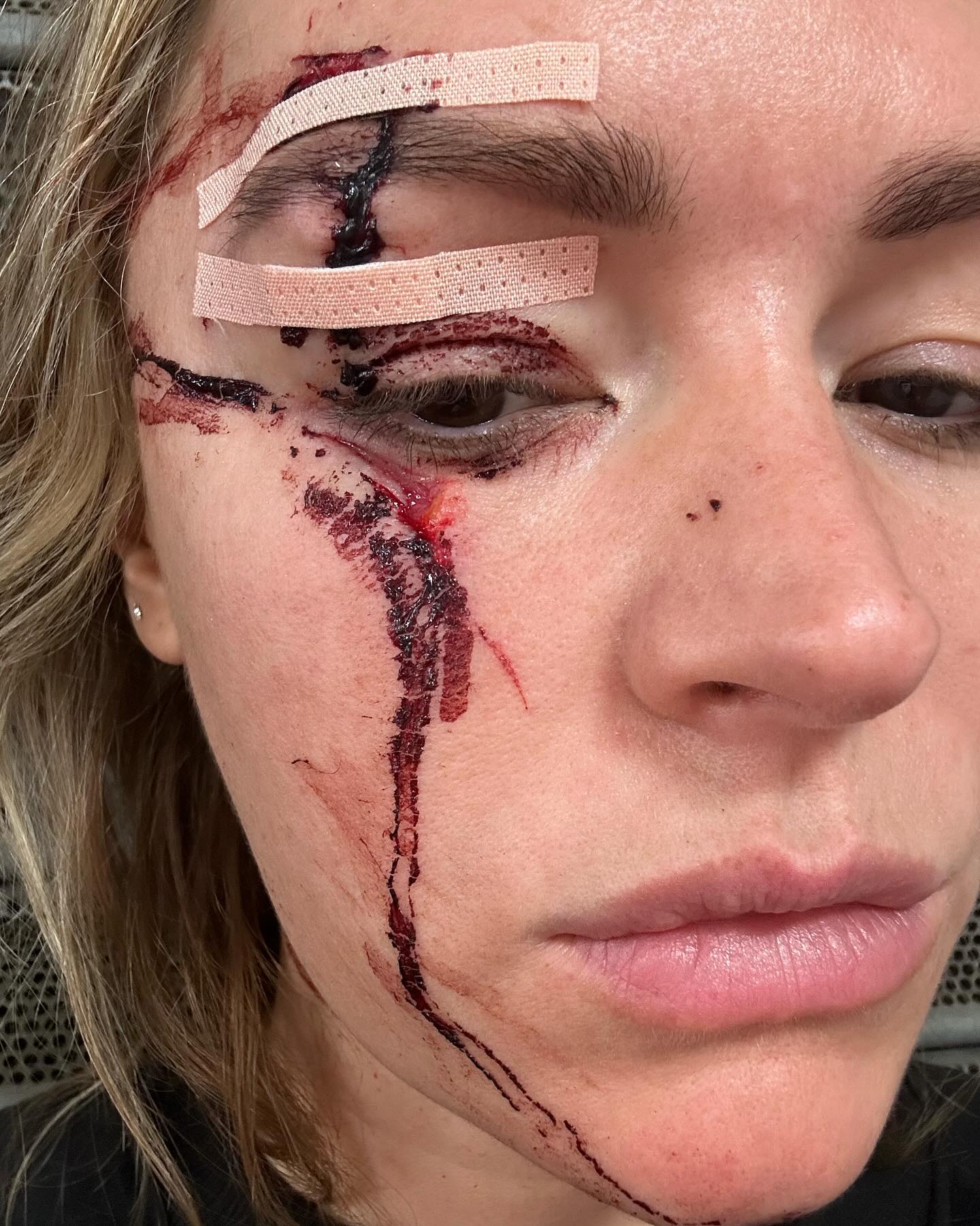 The star suffered a nasty cut to her face and arm on holiday