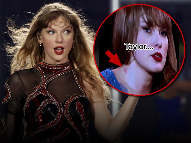 Taylor Swift Appears to Have a Hickey in Sweden, After Travis Kelce ...