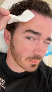 Kevin Jonas was diagnosed with skin cancer and had to have surgery