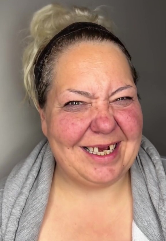 A woman has left people stunned after showing her incredible catfish transformation