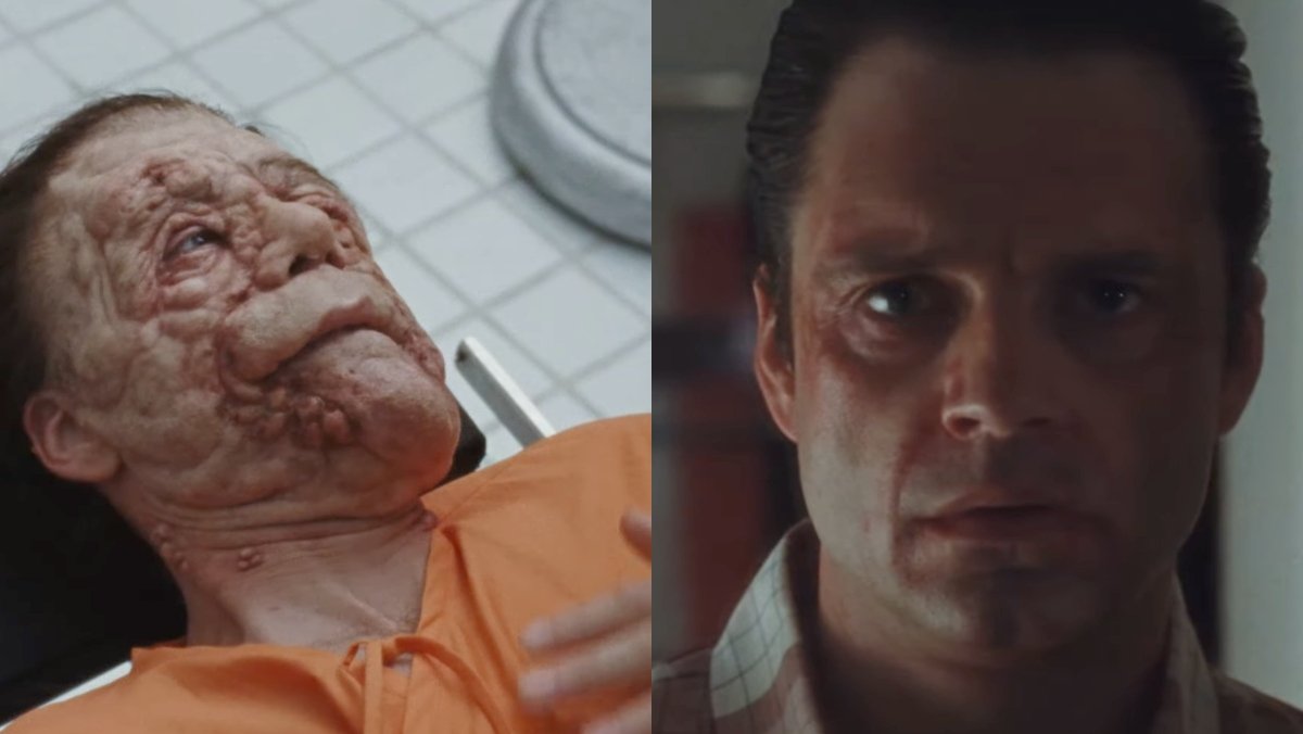 sebastian stan in a24 movie a different man before and after using a drug 