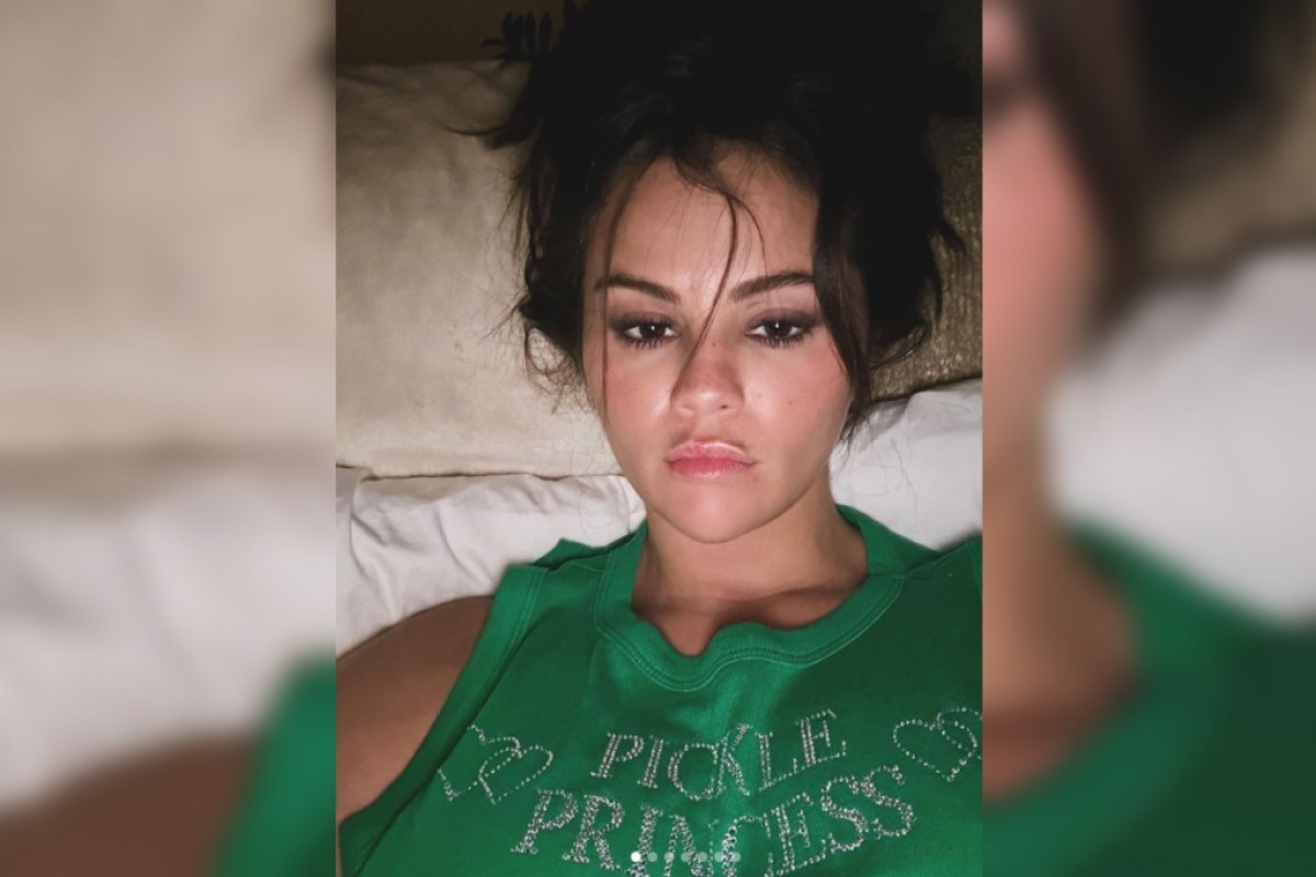 selena-gomez-reveals-the-one-cosmetic-procedure-shes-had-done