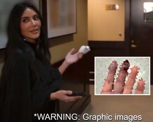Kim Kardashian Reveals Her Son Has a Rare Skin Condition
