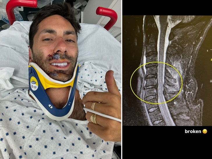 nev shulman broken neck