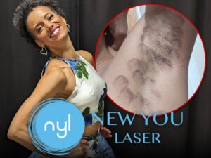 new you laser main composite