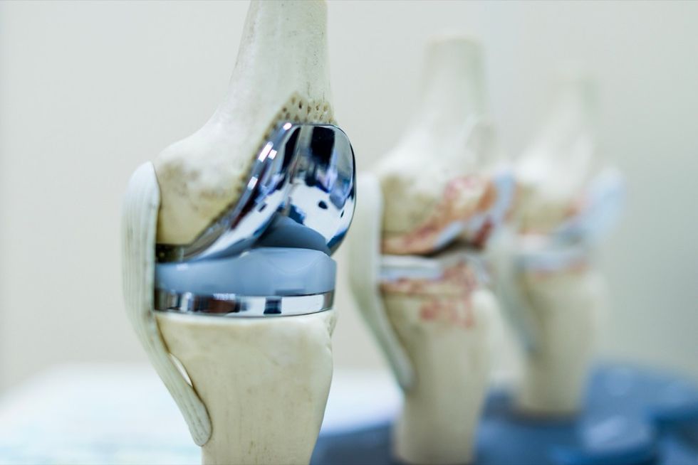 New Treatment Approach May Delay a Knee Replacement — Best Life