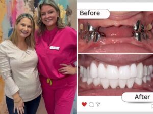 Gypsy Rose Blanchard Shows Off New Teeth After Dental Surgery: 'The Best Glow Up'