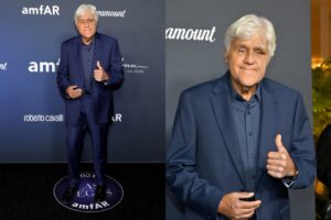 jay-leno-hits-red-carpet-swollen-bruised-face-fall1