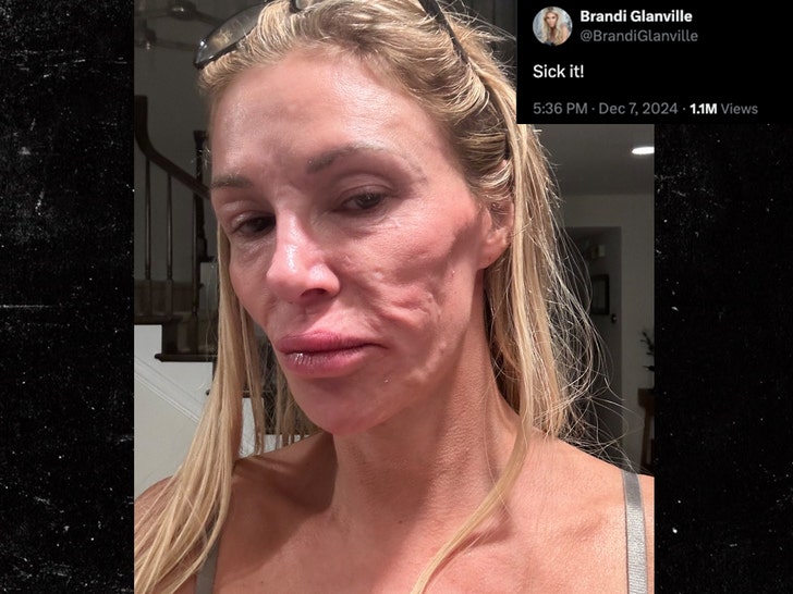 brandi glanville face