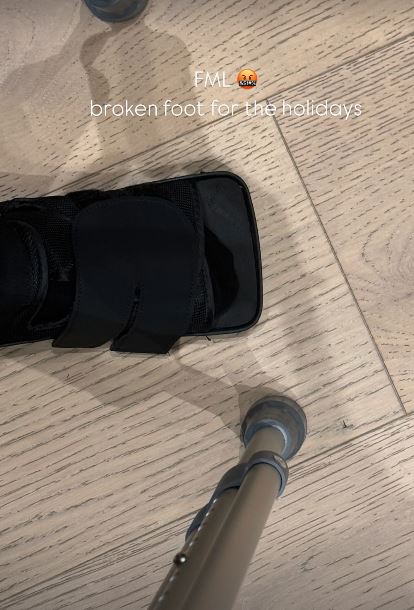 Kim told fans last week she'd broken her foot