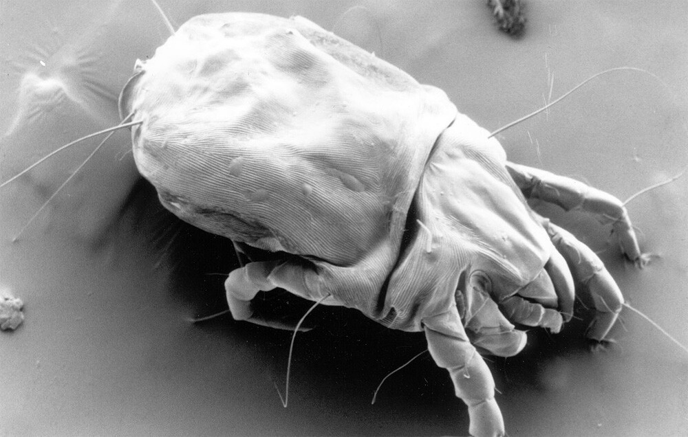 A scanning electron micrograph of a female dust mite