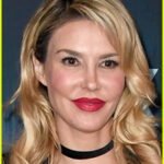 Brandi Glanville Makes First Public Appearance Amid Face 'Parasite' Crisis