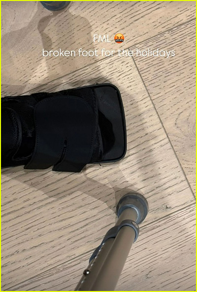 Kim Kardashian insta story of broken foot