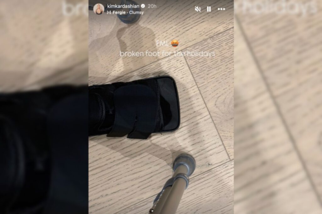 kim-kardashian-shares-snapshot-of-her-broken-foot-fml-foot