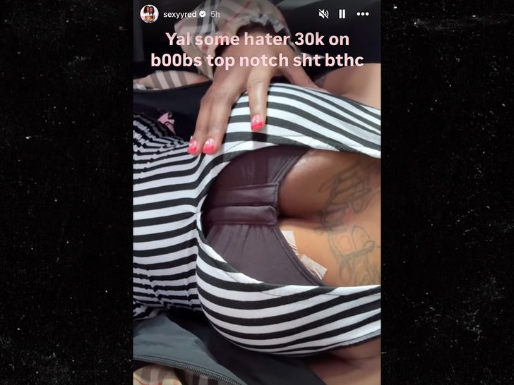 sexyy red boob job update sub instagram