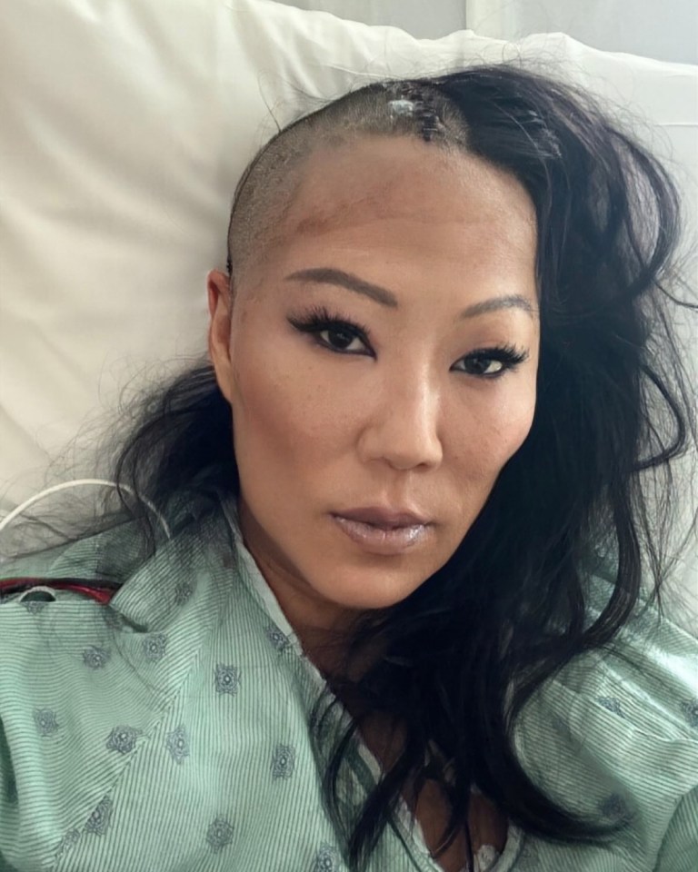 Lynn Ban in a hospital gown, partially shaved head.