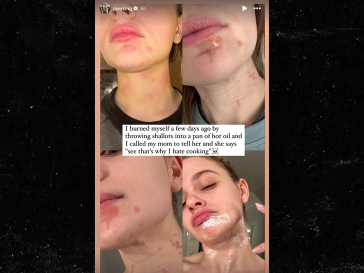 joey king face injuries