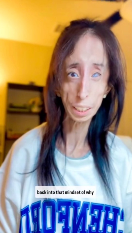 Lizzie Velásquez in a video, discussing her health.