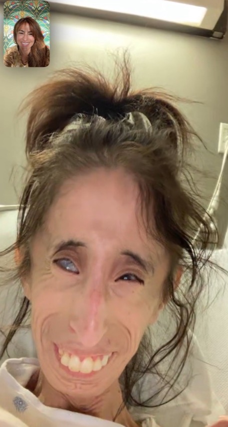 Lizzie Velasquez in a hospital bed, video chatting with another woman.